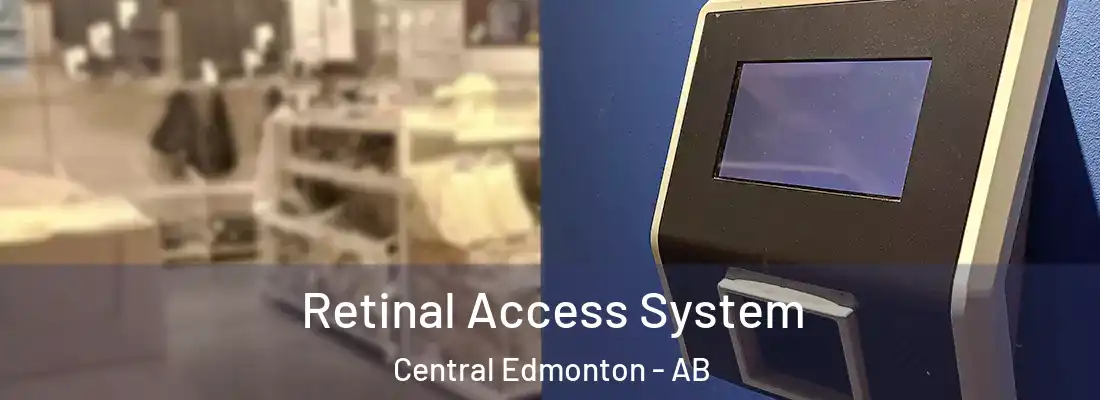  Retinal Access System Central Edmonton - AB